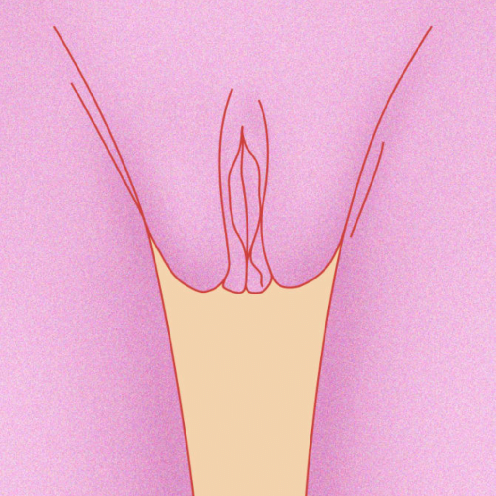 The Innie Vagina in the list of ten types of vagina