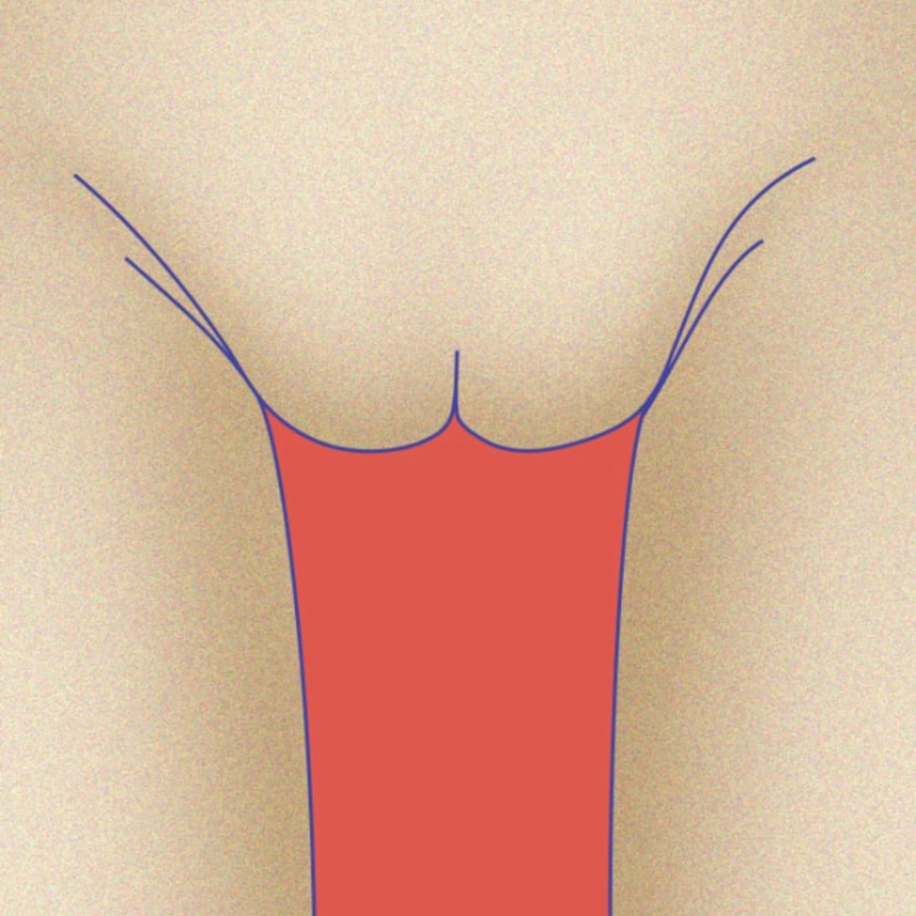 The Small Vagina in the the list of ten types of vagina